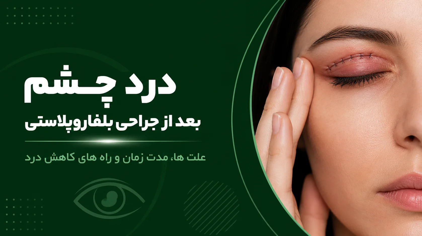 درد چشم بعد از جراحی بلفاروپلاستی
